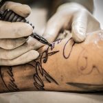 What to Consider When Removing a Tattoo