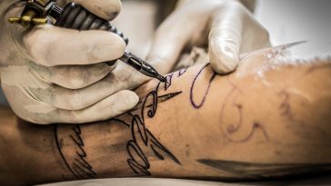 What to Consider When Removing a Tattoo