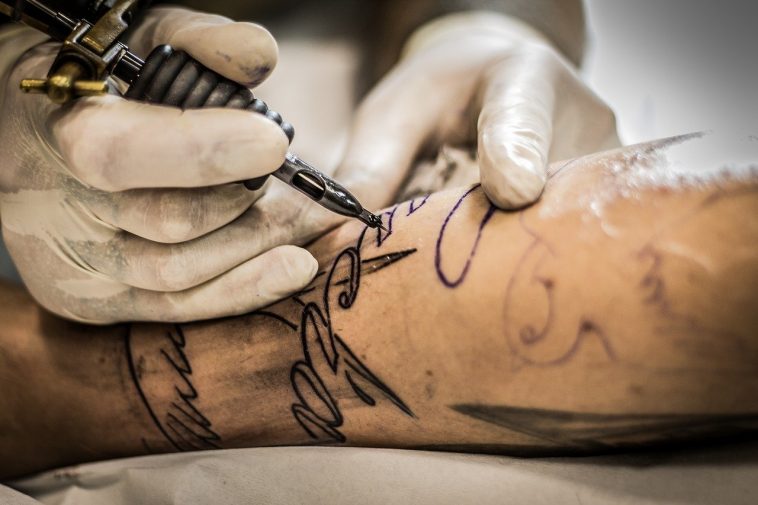 What to Consider When Removing a Tattoo