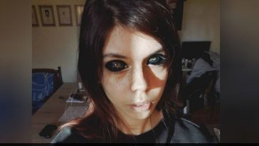 Model Loses Eyesight After Getting Eyeballs Tattooed Black