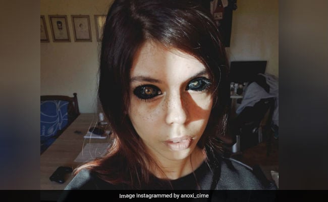 Model Loses Eyesight After Getting Eyeballs Tattooed Black